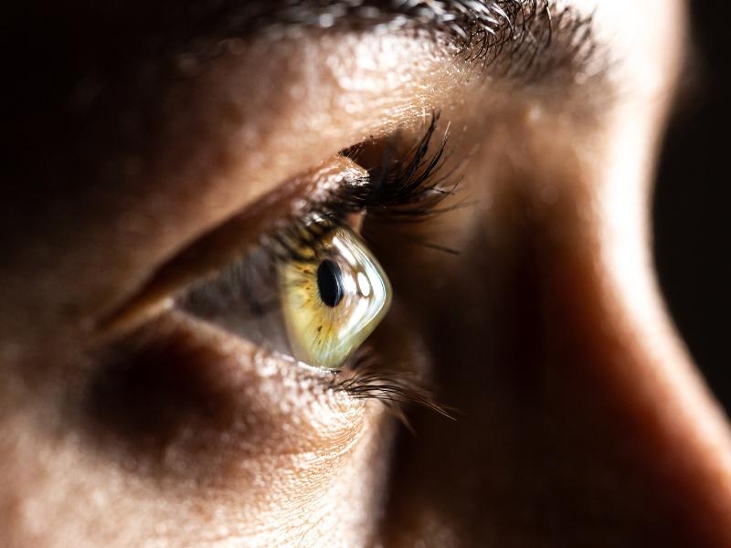 Ceratocone com tratamento Epioxa: para quem serve, quando usar e quais os resultados